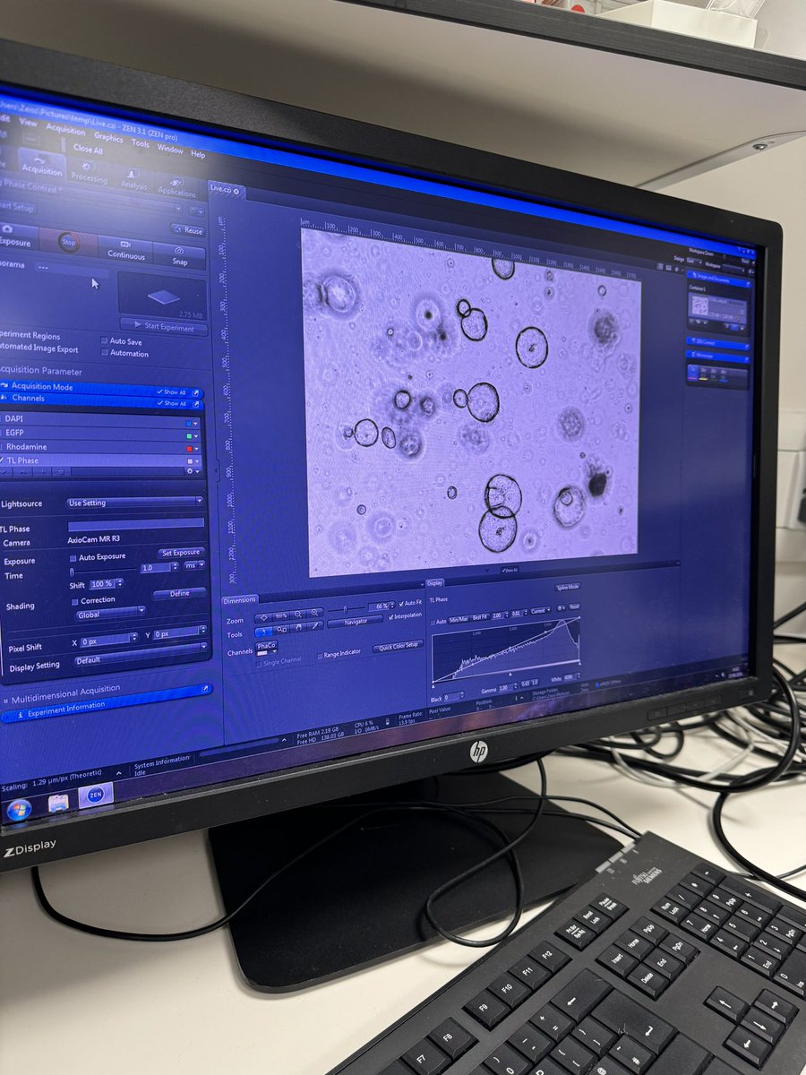 CDH UK (@cdhuk_charity) on Twitter photo We had a great catch up with researchers <a href="/GerliLab/">Mattia FM Gerli, PhD</a> last week! Astounding and groundbreaking work from this brilliant team including <a href="/paolodecoppi/">Paolo De Coppi</a> excited and honoured to be supporting their work 🔬thanks for having us at your amazing facility! We had a great catch up with researchers <a href="/GerliLab/">Mattia FM Gerli, PhD</a> last week! Astounding and groundbreaking work from this brilliant team including <a href="/paolodecoppi/">Paolo De Coppi</a> excited and honoured to be supporting their work 🔬thanks for having us at your amazing facility!