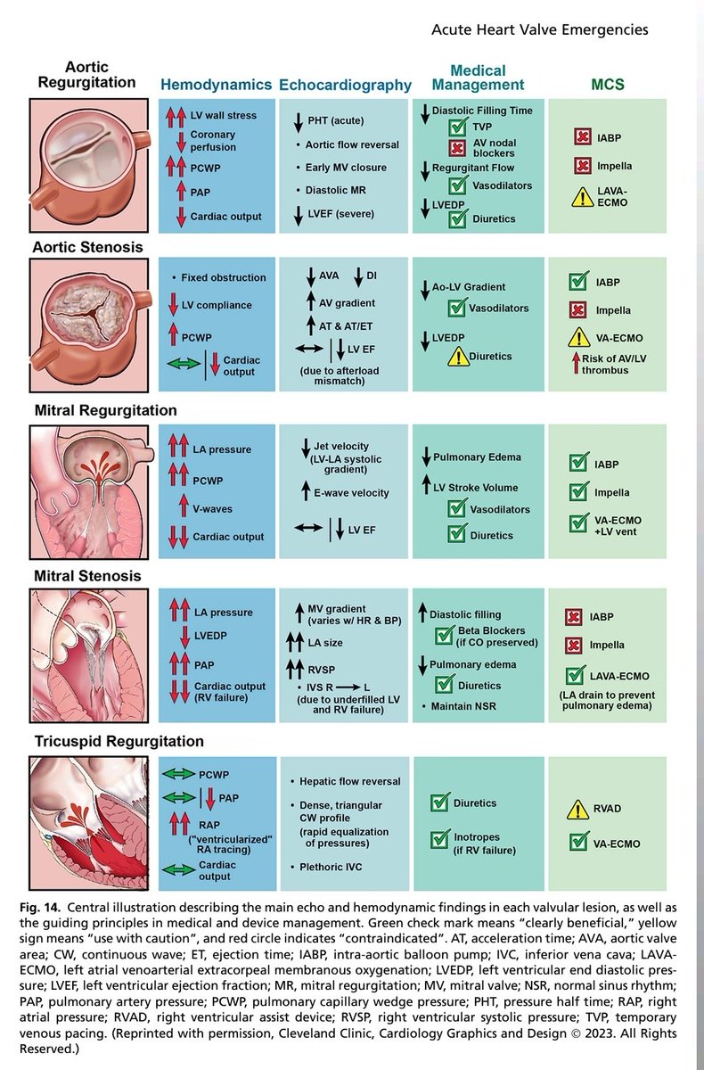 DrAkhilX's tweet image. 🌟ACUTE HEART VALVE EMERGENCIES