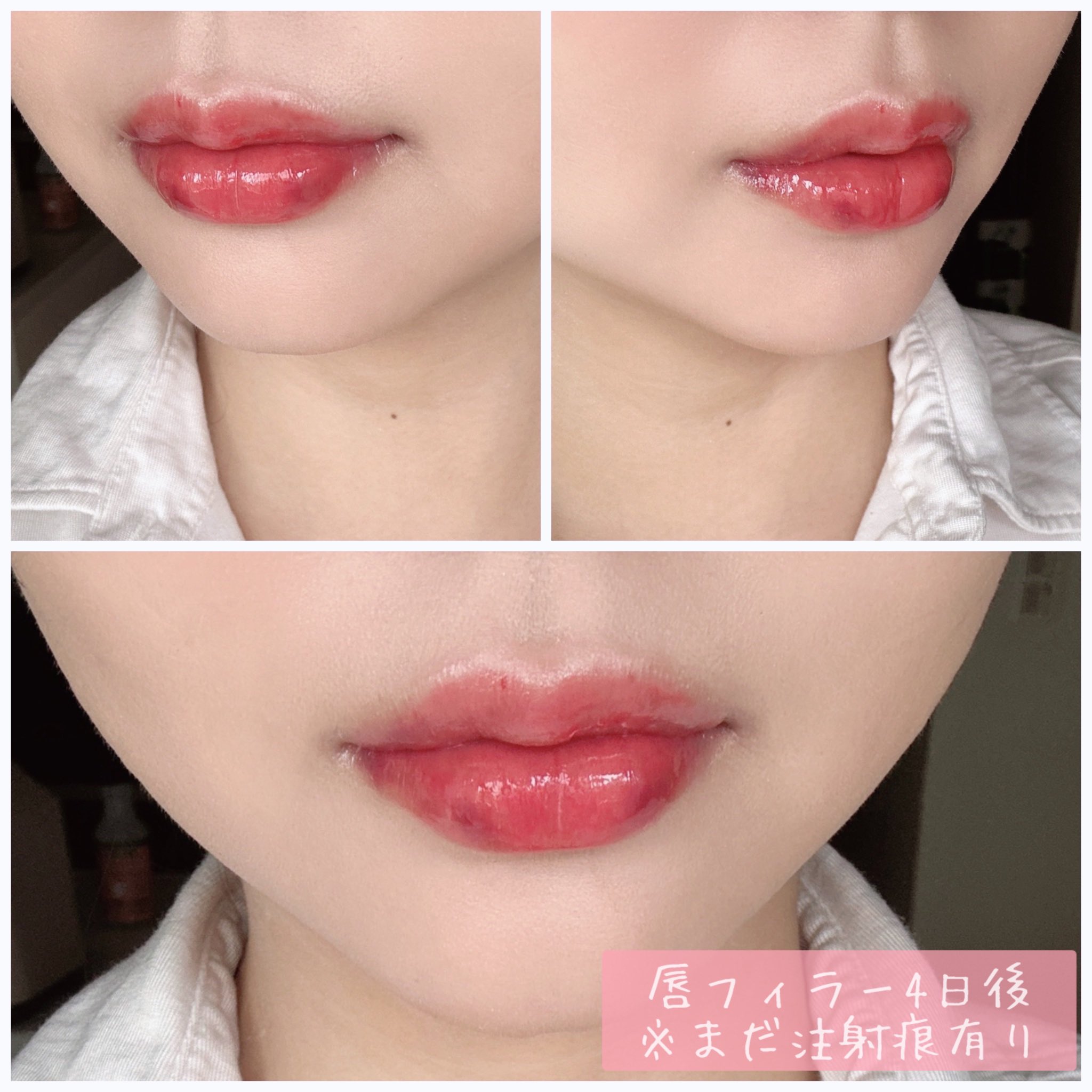 LIPS！唇の形！ Fカラー SI2/0.312ct/RT1387/CGL