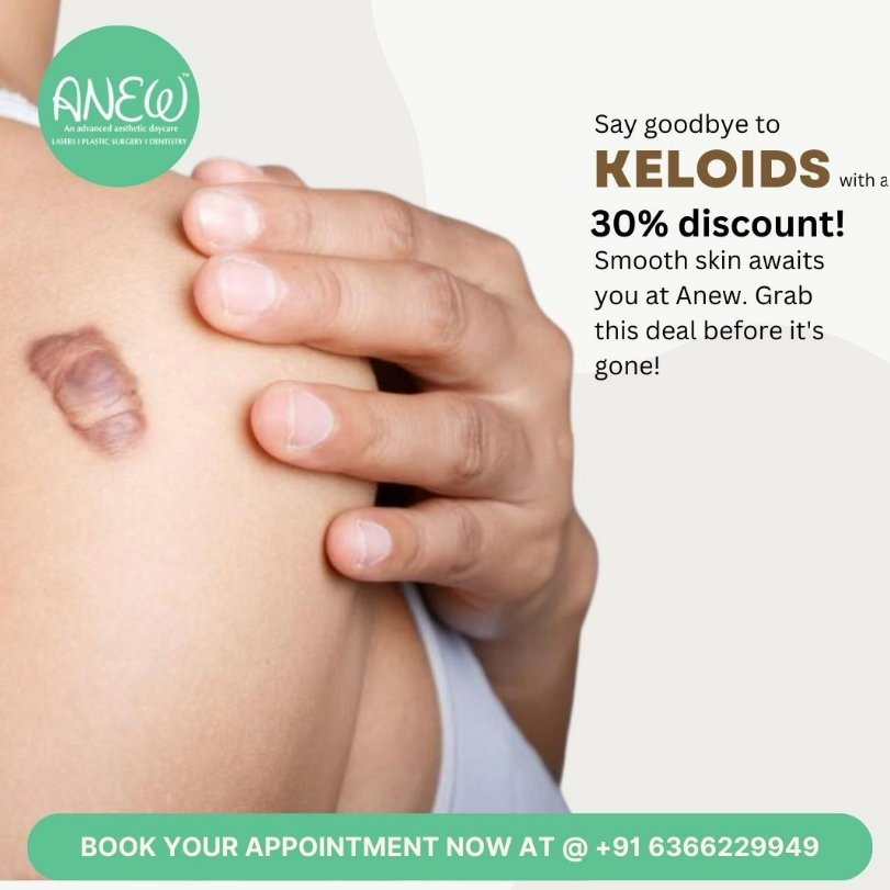 AestheticAnew's tweet photo. Say goodbye to keloids with our advanced treatment! 🎯 Now offering a 30% discount on our specialized keloid removal services.#KeloidTreatment #KeloidRemoval https://t.co/uM2ToPvDaF