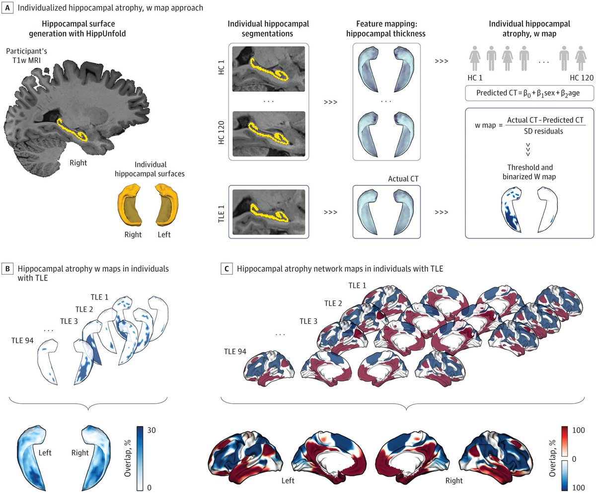 Sara Lariviere (@saratheriver) on Twitter photo How are cortical changes in temporal lobe epilepsy related to the hippocampus, and what does this mean for treatment?
Our study in <a href="/JAMANeuro/">JAMA Neurology</a> shows that white matter changes, cortical atrophy, and successful neurostimulation map to brain networks connected to the hippocampus! How are cortical changes in temporal lobe epilepsy related to the hippocampus, and what does this mean for treatment?
Our study in <a href="/JAMANeuro/">JAMA Neurology</a> shows that white matter changes, cortical atrophy, and successful neurostimulation map to brain networks connected to the hippocampus!