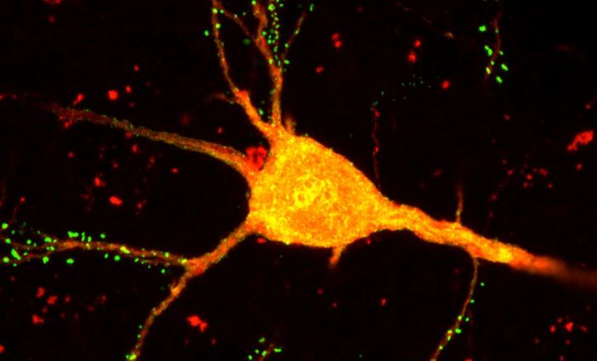 NeuroscienceNew's tweet image. New Brain Mapping Tool Reveals Detailed Neuronal Connections

Researchers have developed a groundbreaking neurotechnology called START, which combines transcriptomics and viral tracing to map precise neuronal connections in the brain. 

This new tool enables scientists to…
