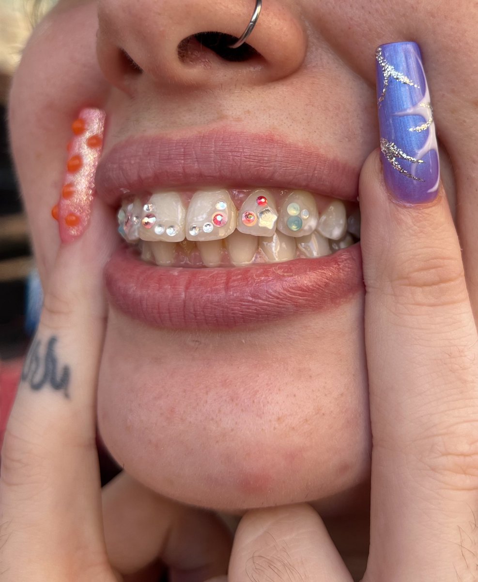 bcartistink's tweet photo. I really ate with this #toothgem freestyle .

#toothgem #nyctoothgems #toothgemtech https://t.co/8LcyrS4YAD