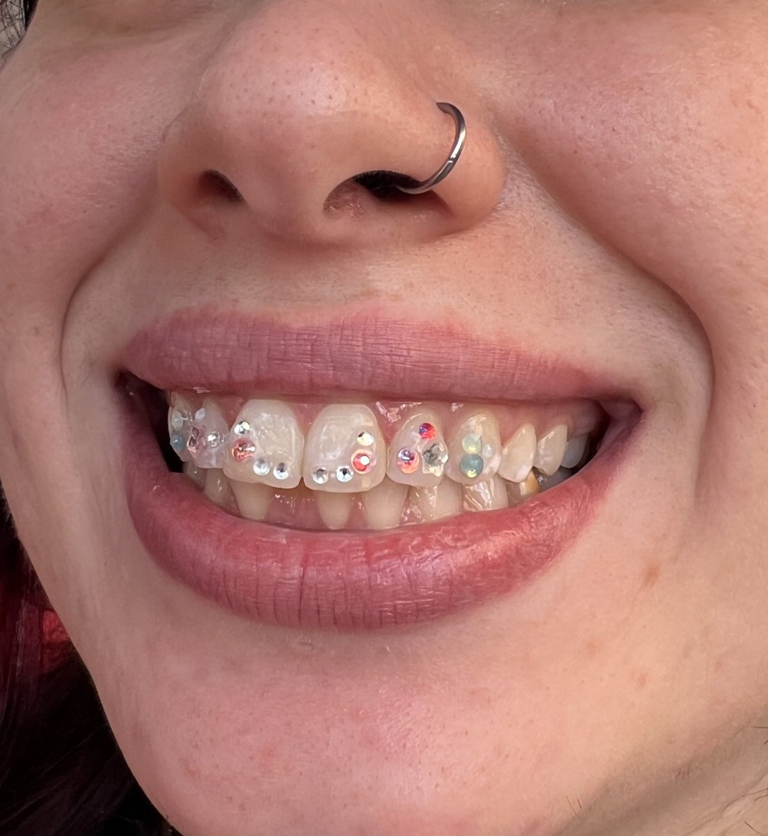 bcartistink's tweet photo. I really ate with this #toothgem freestyle .

#toothgem #nyctoothgems #toothgemtech https://t.co/8LcyrS4YAD