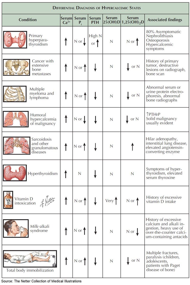 OGdukeneurosurg's tweet image. Hypercalcemia causes