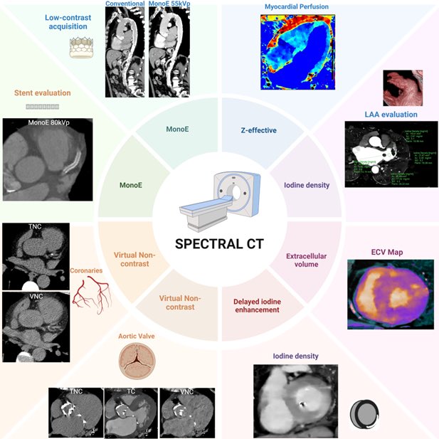 Leandro Slipczuk (@cardiomdphd) on Twitter photo Multienergy Computed Tomography Imaging: Cardiovascular Applications - American College of Cardiology acc.org/Latest-in-Card…
<a href="/danilorenzatti/">Daniel Lorenzatti, MD.</a> <a href="/analyzeF/">Annalisa Filtz</a> <a href="/MonteHeart/">Montefiore Heart</a>
<a href="/ACCinTouch/">American College of Cardiology</a> #ACCimaging Multienergy Computed Tomography Imaging: Cardiovascular Applications - American College of Cardiology acc.org/Latest-in-Card…
<a href="/danilorenzatti/">Daniel Lorenzatti, MD.</a> <a href="/analyzeF/">Annalisa Filtz</a> <a href="/MonteHeart/">Montefiore Heart</a>
<a href="/ACCinTouch/">American College of Cardiology</a> #ACCimaging
