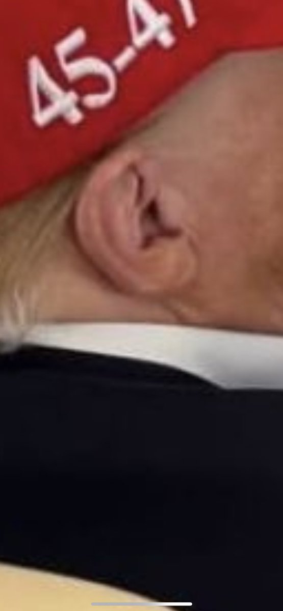 BryanLouisville's tweet photo. @smc429 @realDonaldTrump He "took a bullet to the head" #fakeandstaged https://t.co/Z4Wd9OUjPO