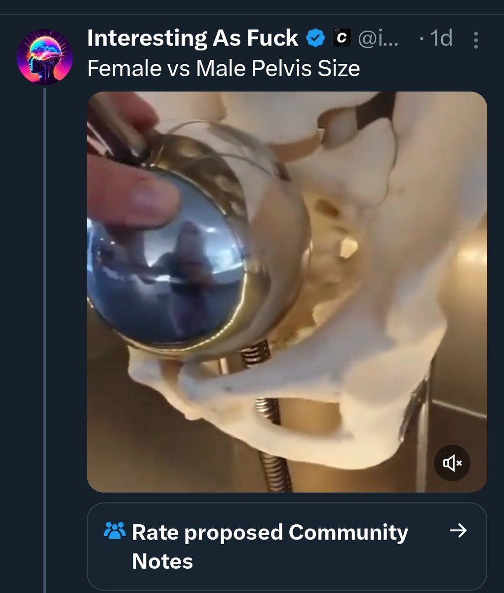 RudeOnion💀 tweet media