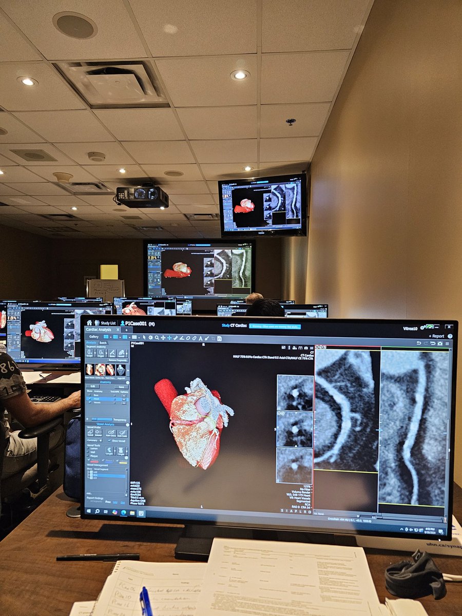 Jônatas Fávero (@jonatasfavero) on Twitter photo Amazing kick-off to the Cardiac CT course at <a href="/UofTMedIm/">UofT Medical Imaging</a> <a href="/imagingtoronto/">University Medical Imaging Toronto (UMIT)</a> Huge thanks to <a href="/minipakkal/">minipakkal</a> for sharing her knowledge through outstanding cases. Great learning experience! Amazing kick-off to the Cardiac CT course at <a href="/UofTMedIm/">UofT Medical Imaging</a> <a href="/imagingtoronto/">University Medical Imaging Toronto (UMIT)</a> Huge thanks to <a href="/minipakkal/">minipakkal</a> for sharing her knowledge through outstanding cases. Great learning experience!