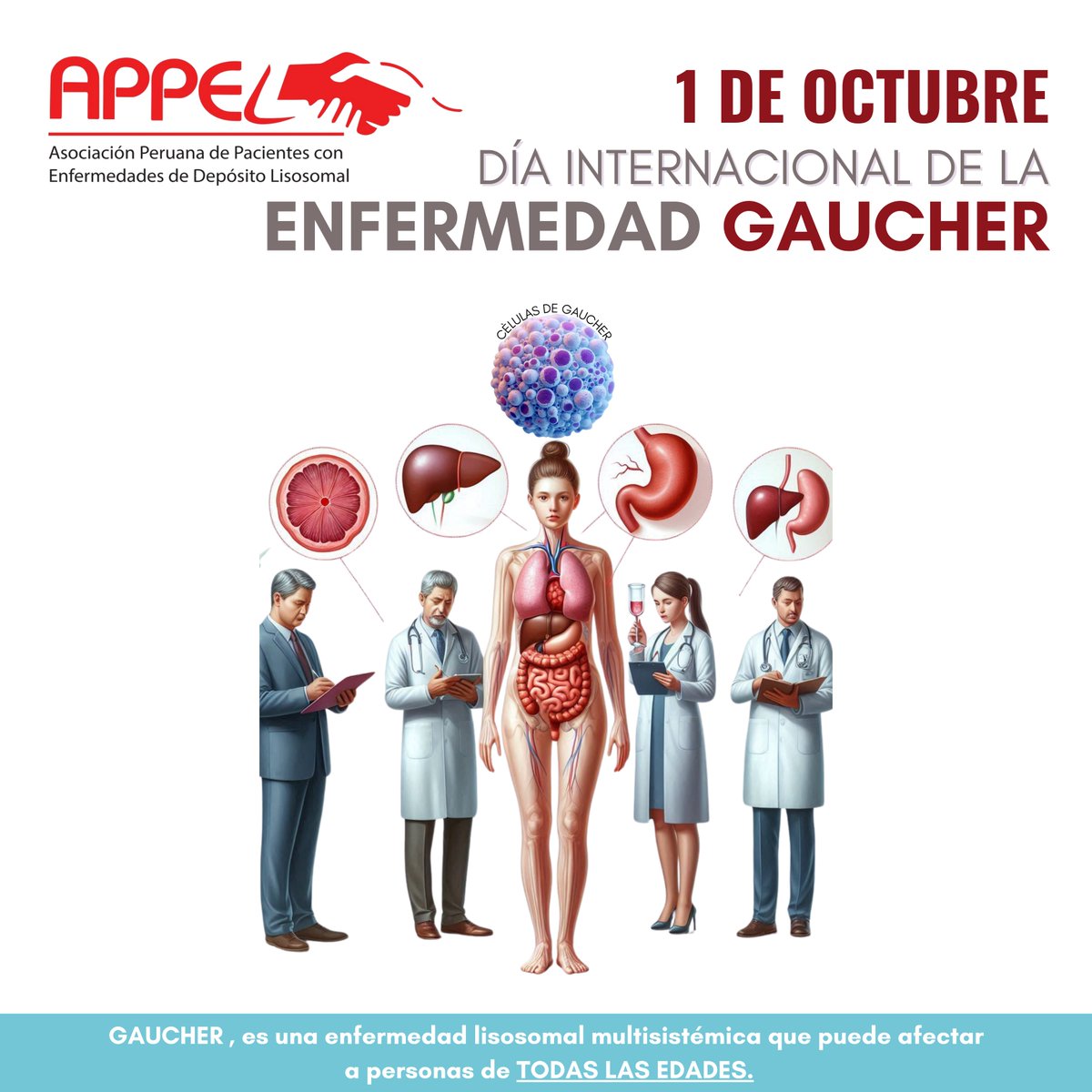 peruappel's tweet photo. En @appelperu , queremos aprovechar este mes para concientizar sobre esta enfermedad lisosomal, multisistémica que puede afectar a personas de todas las edades en el🌍

Juntos, podemos hacer la diferencia🤝
#DíaInternacionalGaucher
#EnfermedadesLisosomales
#APPELPerú https://t.co/zm8hGXqExe