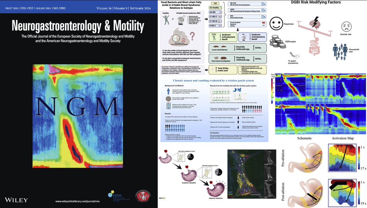 Neurogastro & Motil (@ngmjournal) on Twitter photo 🚨Be sure to check out September 2024 issue‼️
✅Dive deep into the latest research🔥
📣onlinelibrary.wiley.com/toc/13652982/2…🎉
<a href="/maura_corsetti/">maura corsetti</a> <a href="/IBS_Maastricht/">Daniel Keszthelyi MD PhD RFF</a> #FrankZerbib #KirsteenBrowning <a href="/DrCJBlack/">Chris Black</a> <a href="/AndreaShin_GI/">Andrea Shin</a> <a href="/mpj61/">Michael Jones</a> #FievosChristofi
<a href="/VorkLisa/">Lisa Vork</a> <a href="/ThisIsButt/">Mohsin Butt</a> <a href="/Pierfra_Visaggi/">Pierfrancesco Visaggi, MD</a> <a href="/Rajan___Singh/">Rajan Singh</a> 🚨Be sure to check out September 2024 issue‼️
✅Dive deep into the latest research🔥
📣onlinelibrary.wiley.com/toc/13652982/2…🎉
<a href="/maura_corsetti/">maura corsetti</a> <a href="/IBS_Maastricht/">Daniel Keszthelyi MD PhD RFF</a> #FrankZerbib #KirsteenBrowning <a href="/DrCJBlack/">Chris Black</a> <a href="/AndreaShin_GI/">Andrea Shin</a> <a href="/mpj61/">Michael Jones</a> #FievosChristofi
<a href="/VorkLisa/">Lisa Vork</a> <a href="/ThisIsButt/">Mohsin Butt</a> <a href="/Pierfra_Visaggi/">Pierfrancesco Visaggi, MD</a> <a href="/Rajan___Singh/">Rajan Singh</a>