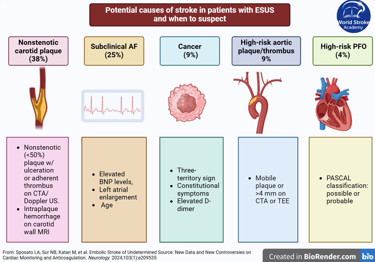 #MondayTip
☝️We have learned that #ESUS is not just about atrial fibrillation

Some potential causes of #stroke in patient with ESUS
💡and when to suspect 🧐

From <a href="/SposatoL/">Luciano Sposato 🇦🇷🇨🇦</a> et al. review <a href="/GreenJournal/">Neurology Journal</a> 
doi.org/10.1212/WNL.00…
