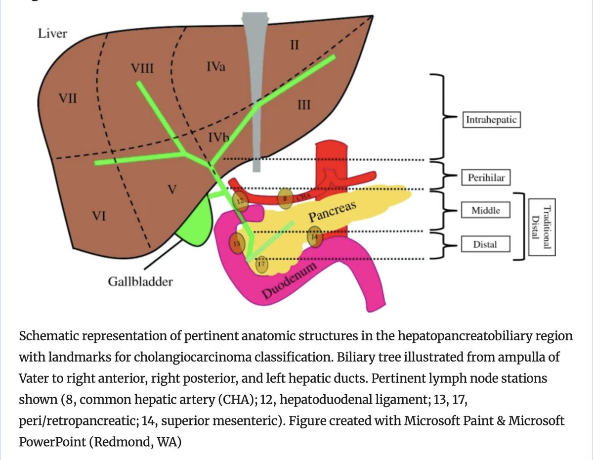 Annals of Surgical Oncology (@annsurgoncol) on Twitter photo October Issue: #Cholangiocarcinoma of the Middle Bile Duct: A Narrative Review <a href="/RichSchulickMD/">Richard Schulick, MD</a> <a href="/IA_Ziogas/">Ioannis A. Ziogas, MD, MPH</a> <a href="/DimitriosMoris/">Dimitrios Moris MD, MSc, PhD</a> @AnaGleisner
rdcu.be/dVB8q
<a href="/BotelhoDra/">Dra. Jordana B Vilela</a>
<a href="/SyedAAhmad5/">Syed A. Ahmad</a> October Issue: #Cholangiocarcinoma of the Middle Bile Duct: A Narrative Review <a href="/RichSchulickMD/">Richard Schulick, MD</a> <a href="/IA_Ziogas/">Ioannis A. Ziogas, MD, MPH</a> <a href="/DimitriosMoris/">Dimitrios Moris MD, MSc, PhD</a> @AnaGleisner
rdcu.be/dVB8q
<a href="/BotelhoDra/">Dra. Jordana B Vilela</a>
<a href="/SyedAAhmad5/">Syed A. Ahmad</a>