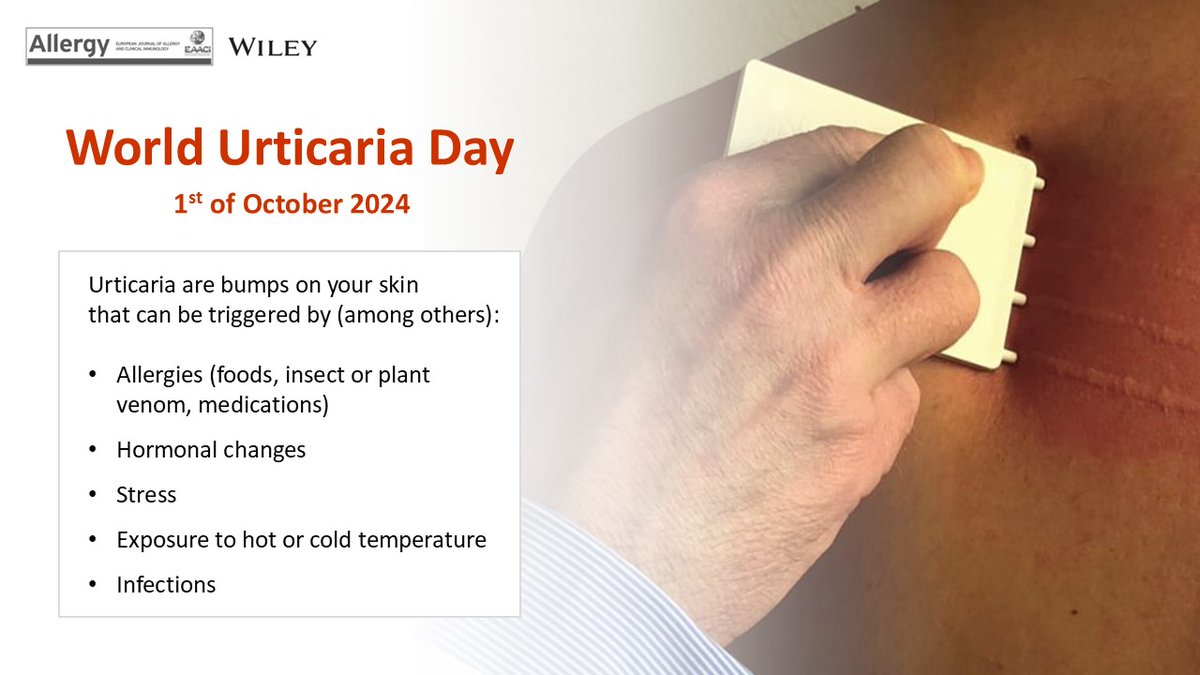Urticaria is a skin condition that currently affects 20% of the population at some point in their lives. As part of #WorldUrticariaDay, celebrated on the 1st of October, we highlight research articles published in #Allergy on the cellular and molecular mechanisms leading to this