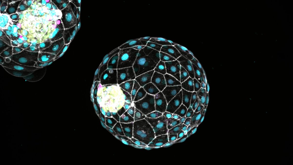 Max Planck Society (@maxplanckpress) on Twitter photo Pausenknopf in der menschlichen Entwicklung entdeckt:
Auch der Mensch könnte einen Mechanismus besitzen, die Entwicklung eines Embryos vorübergehend zu verlangsamen, so Forschende <a href="/oeaw/">Austrian Academy of Sciences</a> und <a href="/MPI_MolGen/">MPI for Molecular Genetics</a> -> mpg.de/23506724/0926-… #Diapause Pausenknopf in der menschlichen Entwicklung entdeckt:
Auch der Mensch könnte einen Mechanismus besitzen, die Entwicklung eines Embryos vorübergehend zu verlangsamen, so Forschende <a href="/oeaw/">Austrian Academy of Sciences</a> und <a href="/MPI_MolGen/">MPI for Molecular Genetics</a> -> mpg.de/23506724/0926-… #Diapause