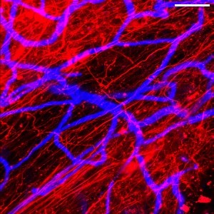 BU_NPC's tweet image. Professors Martin Thunemann and Ella Zeldich were recently awarded $2.3M from @NIH for their project, &quot;Understanding neuronal dysfunction in Down Syndrome using assembloids and xenotransplanted cortical organoids&quot;

Full article here: lnkd.in/eBxDuNnr