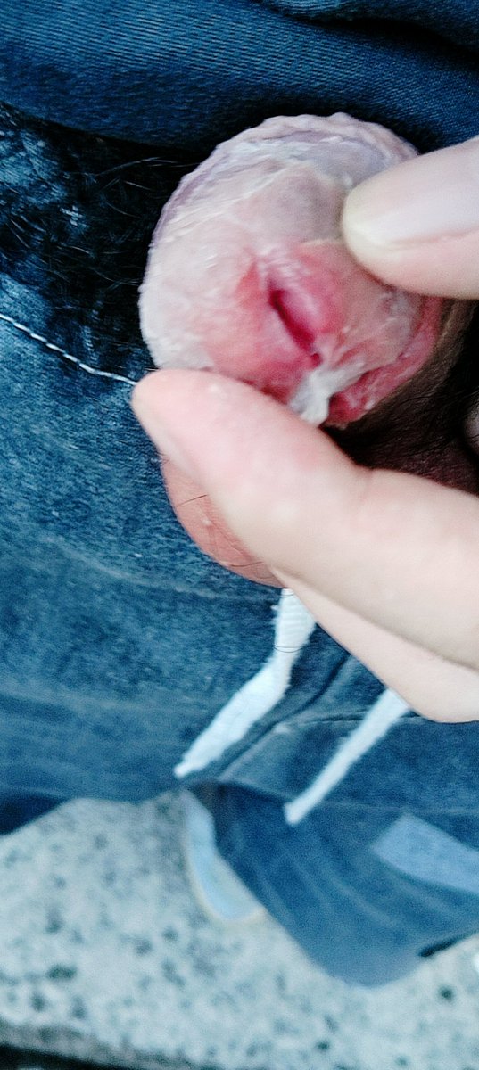 被踩，被滴胶水，发不了视频将就看吧