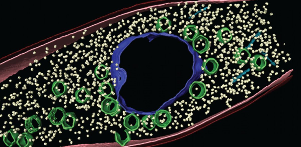 Just heard "phiKZ is a nucleus-forming phage, so it is not affected by CRISPR..." - just a few years ago, this sentence would have been wild and now it does not surprise anyone at this conference
<a href="/PoglianoJoe/">Joe Pogliano</a> <a href="/joeBondyDenomy/">Joe Bondy-Denomy</a> 

#LoveVirology