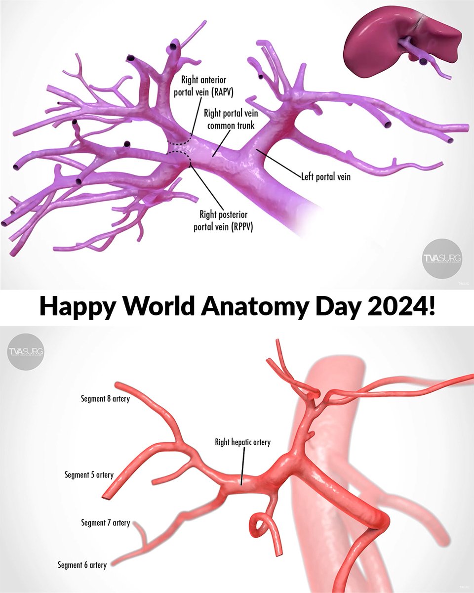 Happy World Anatomy Day! Here's a throwback to a presentation and video series we made about variations we've seen in liver vasculature. Check out more anatomy in action at TVASurg: pie.med.utoronto.ca/TVASurg/

#worldanatomyday #worldanatomyday2024
