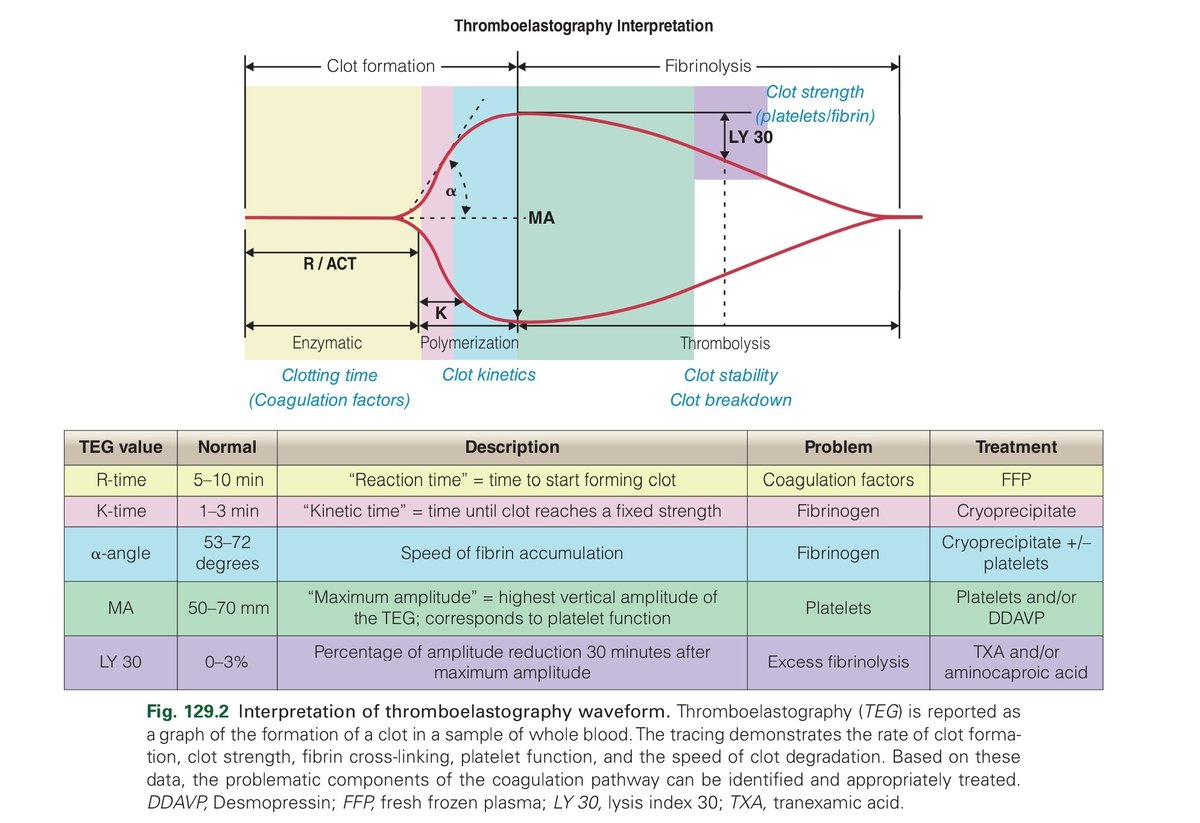 🌟THROMBOELASTOGRAPHY (TEG) - Interpretation