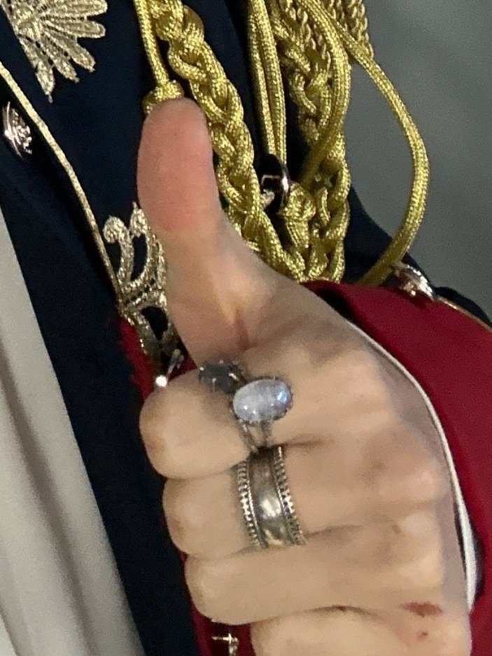 그럼 이때 손에 난 상처가... ㅠㅠㅠㅠㅠㅠㅠㅠㅠ