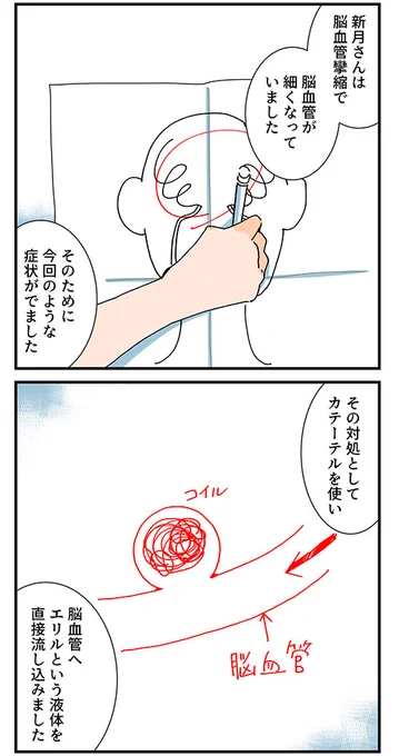 (7/8)手術内容を教えてもらう 