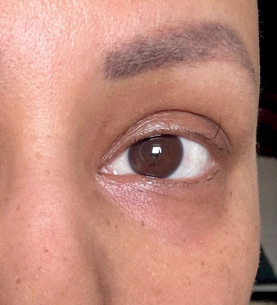 schoolofbharat's tweet photo. 💪 Brave & Inspiring: Hina Khan’s Fight Against Cancer

As #HinaKhan shares an emotional image of her last remaining eyelash amidst her chemotherapy journey, her resilience shines through:

“This brave, lone warrior has fought it all.”

Her courage, strength, and positivity are a true inspiration to all facing similar battles. Sending love and support to Hina as she continues to fight with grace and bravery. 💖🌟

#CancerAwareness #StayStrong #Inspiration #HinaKhan #BraveHeart #PuneTimes