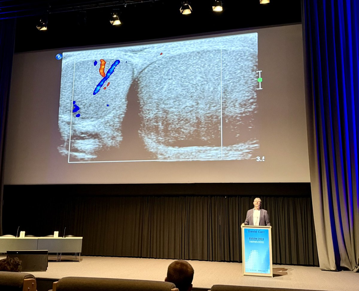 Adriana Gil (@agilrodrigo) on Twitter photo He has a Testicular Torsion!!🏃🏻♀️😱😱
Put the probe and Push Color Doppler!
Testicular POCUS in ED <a href="/davidcarr333/">David Carr</a> #POCUS #EUSEM2024 He has a Testicular Torsion!!🏃🏻♀️😱😱
Put the probe and Push Color Doppler!
Testicular POCUS in ED <a href="/davidcarr333/">David Carr</a> #POCUS #EUSEM2024