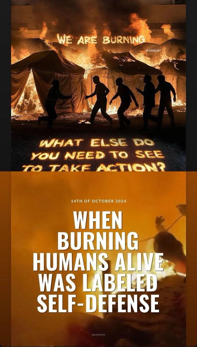 Burned alive!