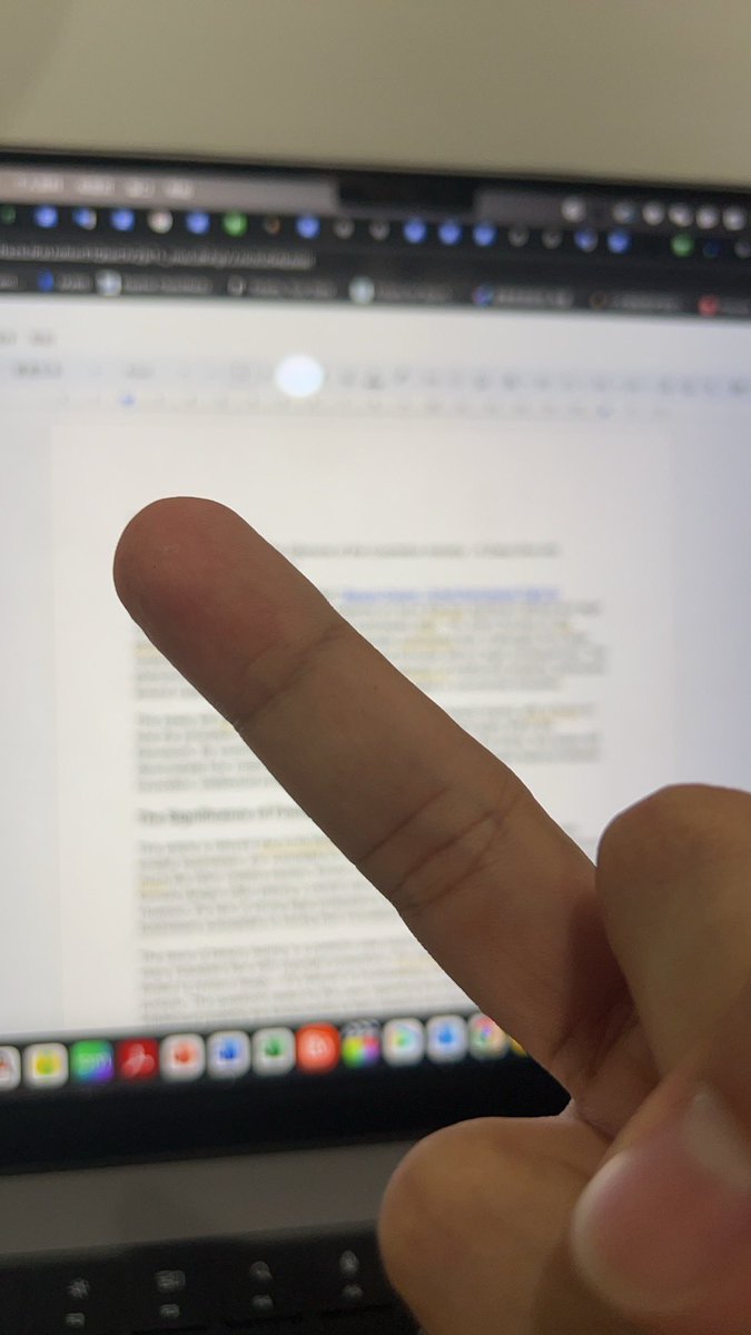 MOCHACCC tweet media