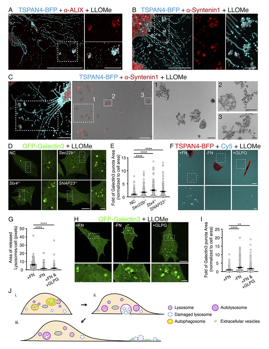 Journal of Cell Biology (@jcellbiol) on Twitter photo Migration-dependent autolysosome exocytosis could release sEVs and maintain lysosomal homeostasis in response to #lysosome damage. From Takami Sho, Li Yu et al <a href="/Tsinghua_Uni/">Tsinghua University</a> showing that migratory autolysosome disposal mitigates lysosome damage. hubs.la/Q02Rwnyn0
#autophagy Migration-dependent autolysosome exocytosis could release sEVs and maintain lysosomal homeostasis in response to #lysosome damage. From Takami Sho, Li Yu et al <a href="/Tsinghua_Uni/">Tsinghua University</a> showing that migratory autolysosome disposal mitigates lysosome damage. hubs.la/Q02Rwnyn0
#autophagy