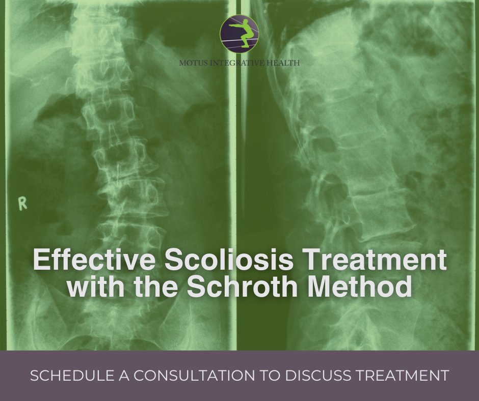 motusinhealth_'s tweet image. Achieve better alignment and posture with the Schroth Method. Specialized care for scoliosis patients of all ages. Book an appointment with us today!
#SchrothMethod #ScoliosisSupport

bit.ly/4c1F4RY