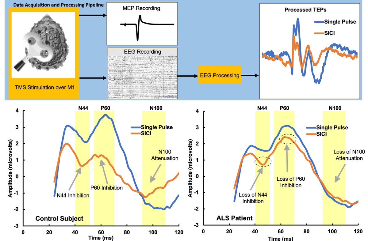 Brain1878's tweet image. By combining TMS with advanced EEG, van den Bos et al. probe the functional structure of the abnormal neural networks thought to drive ALS, and conclude that there is strong evidence for cortical hyperexcitability in the underlying disease process. tinyurl.com/r6akxbzx