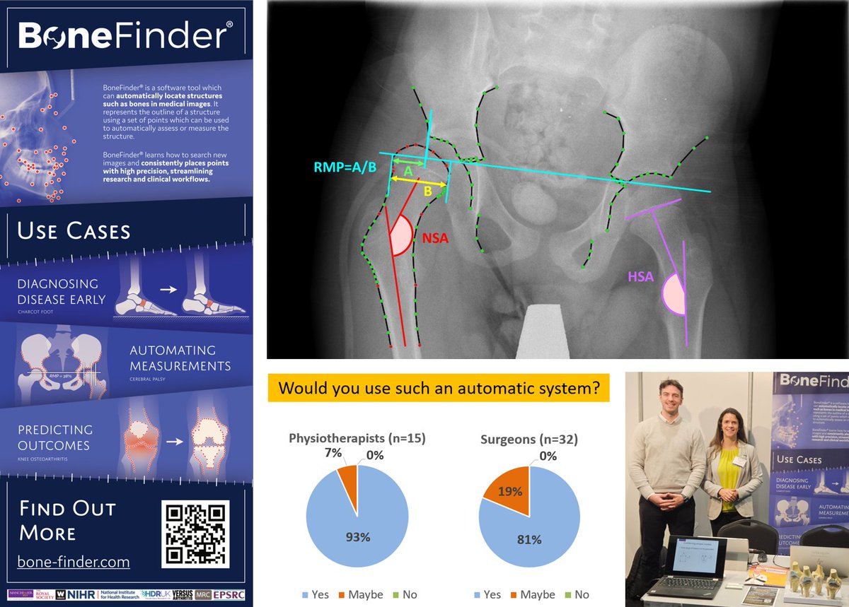Great time at CSP 2024!

We showcased BoneFinder's AI tech &amp; presented "Enhancing Musculoskeletal Care with AI".

We  also highlighted AI's role in paediatric care in our talk "Automating measurements on hip radiographs in children with cerebral palsy".

Thanks to all!

#Physio24