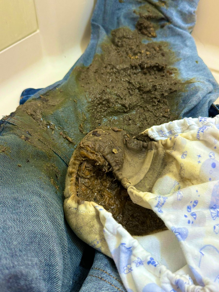 ringoame_scat's tweet photo. 実はおもらししちゃったのはうんちでした
トイレに着く頃にはもうおしりから結構出ちゃってて、ドアの鍵をかけたくらいでうんちしたすぎて止めようとしてるのに勝手にいきんじゃって、ずももももってすごい量出ちゃいました
全部がぐちょぐちょで、ぱんつはうんちでぱんぱんです…
#うんち #おもらし https://t.co/UDfStNs3v2