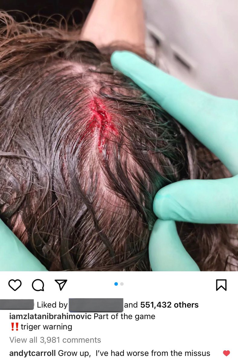 COYIrons tweet media