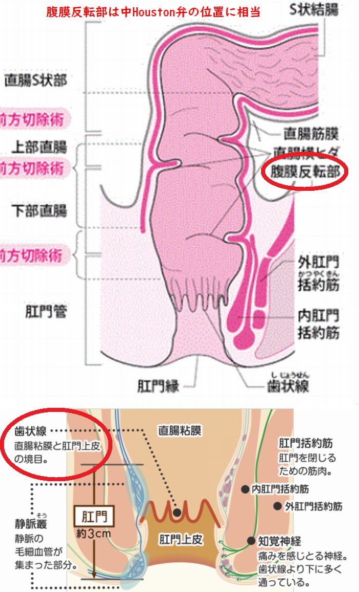 prostate727's tweet photo. 尾てい骨

直腸内で前立腺の反対側(背中側)を刺激し
尾てい骨・仙骨側からも刺激すると

快楽が背骨に伝わり脳天へ

前立腺を刺激すると腹側から伝わるが背側からだと背骨や頸椎を刺激し骨に快楽が発生する

脊髄神経に快楽が走るからか脳天への衝撃度も大きくなる
＃ドライオーガズム　＃脳イキ https://t.co/1qozUgovfR