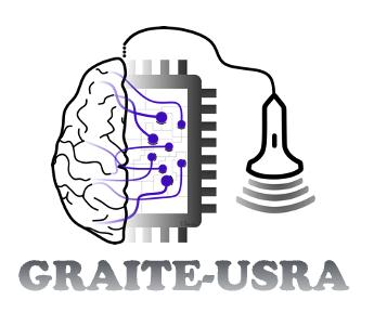 Xiaoxi (@xiaoxi_6) on Twitter photo So excited to launch the GRAITE-USRA study today!
Guidelines for Reporting AI Technology Evaluations – Ultrasound Scanning in Regional Anaesthesia
Stay tuned for updates!
#UGRA #AI #POCUS
<a href="/bowness_james/">James Bowness</a> <a href="/Jennythatcanbl1/">Jennythatcanblock</a> <a href="/davidwhewson/">Dr David Hewson</a> <a href="/STHJournalClub/">Matt Wiles</a> <a href="/GSCollins/">Gary Collins</a> So excited to launch the GRAITE-USRA study today!
Guidelines for Reporting AI Technology Evaluations – Ultrasound Scanning in Regional Anaesthesia
Stay tuned for updates!
#UGRA #AI #POCUS
<a href="/bowness_james/">James Bowness</a> <a href="/Jennythatcanbl1/">Jennythatcanblock</a> <a href="/davidwhewson/">Dr David Hewson</a> <a href="/STHJournalClub/">Matt Wiles</a> <a href="/GSCollins/">Gary Collins</a>
