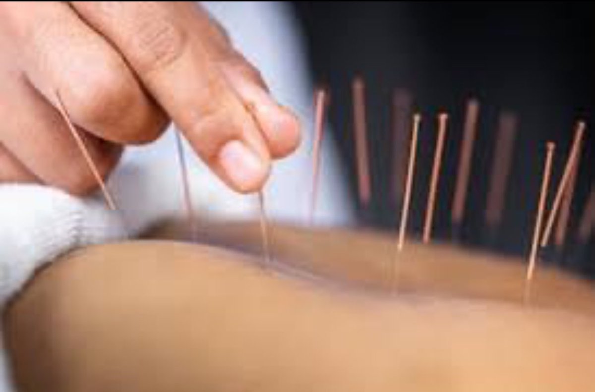Leigh Therapy Centre (@leightherapy) on Twitter photo Acupuncture is now available from this week <a href="/LeighTherapy/">Leigh Therapy Centre</a>  
#Acupuncture can treat: 
Lower back pain 
Chronic pain 
Wrist/Hand injuries 
Tennis Elbow 
Arthritic Knee Pain 
And so much more! 
If youβre interested message the page to speak with one of our Physiotherapists. Acupuncture is now available from this week <a href="/LeighTherapy/">Leigh Therapy Centre</a>  
#Acupuncture can treat: 
Lower back pain 
Chronic pain 
Wrist/Hand injuries 
Tennis Elbow 
Arthritic Knee Pain 
And so much more! 
If youβre interested message the page to speak with one of our Physiotherapists.