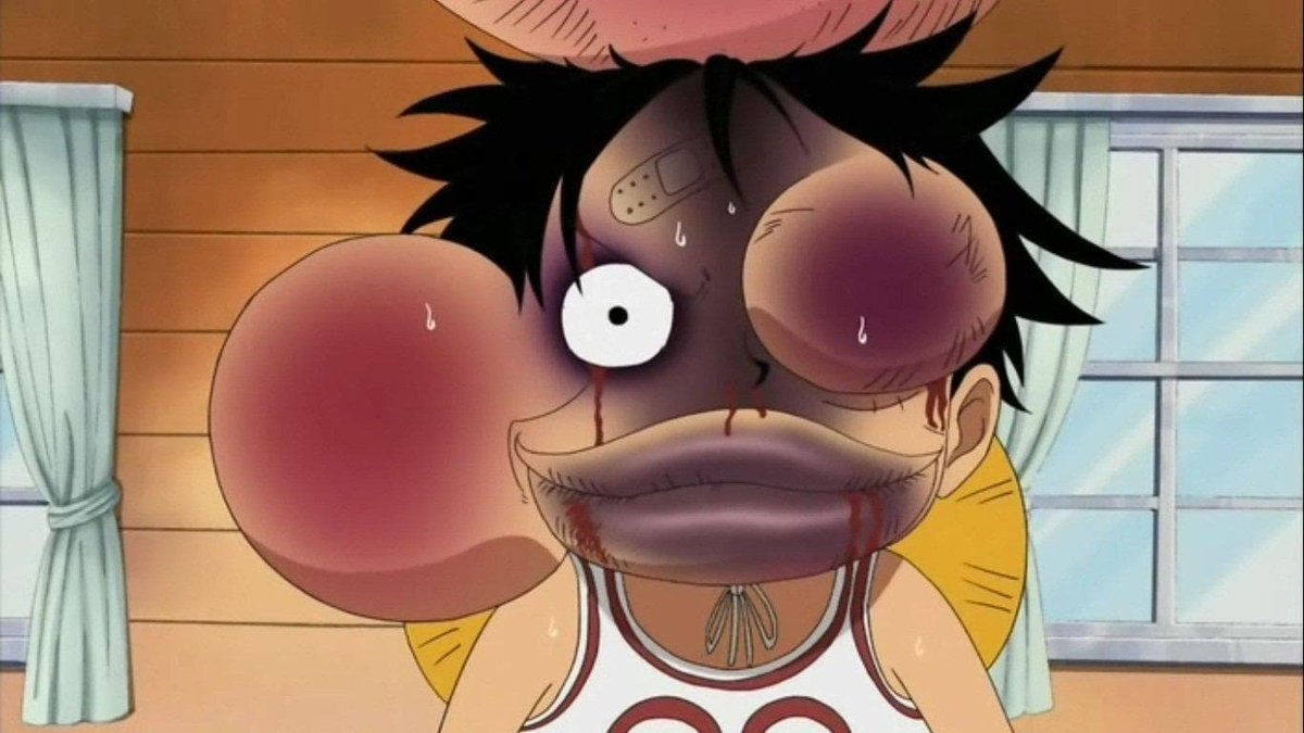 BakugoXIX's tweet photo. "La ranked m'a degouté du jeu" https://t.co/w38X0x9d6x