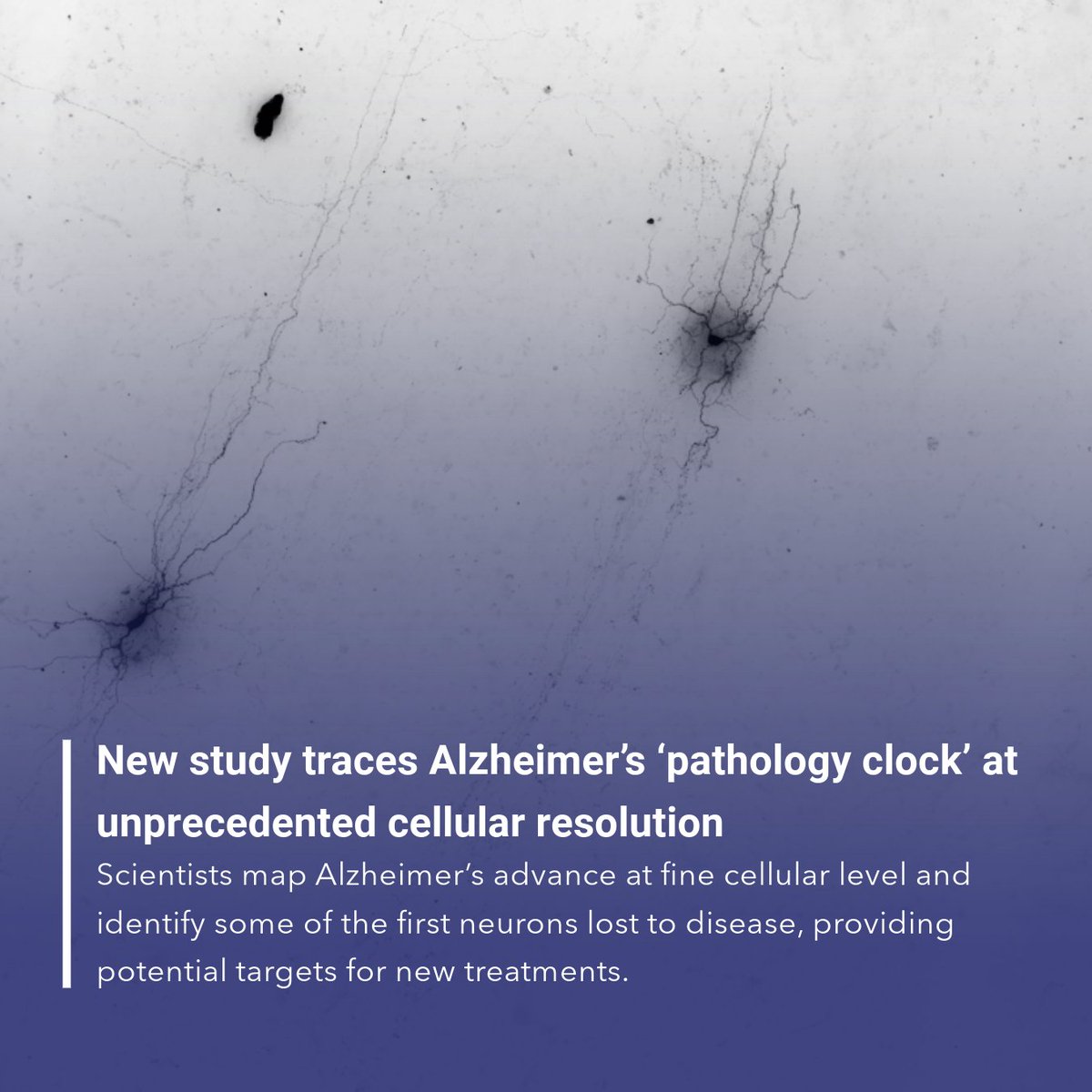 Allen Institute (@alleninstitute) on Twitter photo New insights into Alzheimerās Disease š§ š
In a study with <a href="/UWMedicine/">UW Medicine</a> and <a href="/KPWaResearch/">KP WA Research</a>, researchers have identified some of the first neurons lost in the progression of Alzheimerās Disease and potential future pathways to #EndAlz. š§µ
#studyBRAIN New insights into Alzheimerās Disease š§ š
In a study with <a href="/UWMedicine/">UW Medicine</a> and <a href="/KPWaResearch/">KP WA Research</a>, researchers have identified some of the first neurons lost in the progression of Alzheimerās Disease and potential future pathways to #EndAlz. š§µ
#studyBRAIN