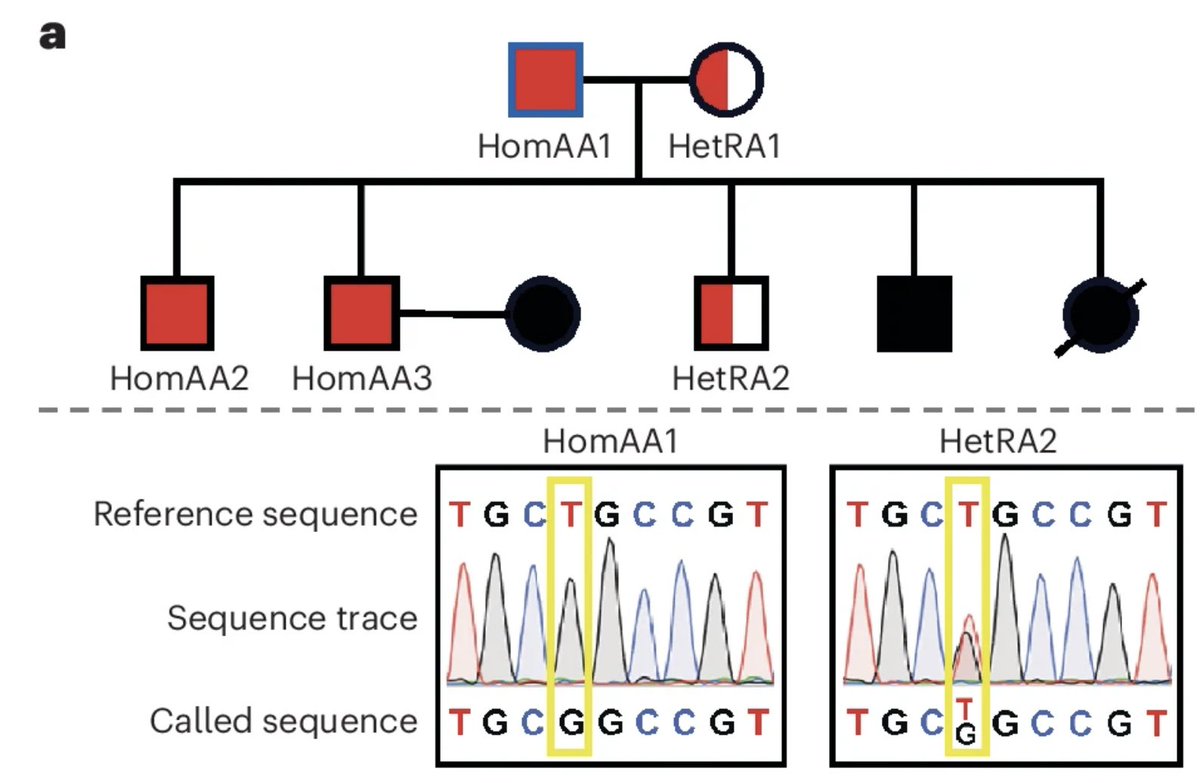 Human genetics informs drug development🧬💊

👉GDF15 is a potential target for hyperemesis gravidarum. BUT fetal &amp; maternal safety unknown❗️

✅GDF15 loss-of-function allele carriers are fertile, have multiple children with no consistent overt phenotypes

nature.com/articles/s4225…