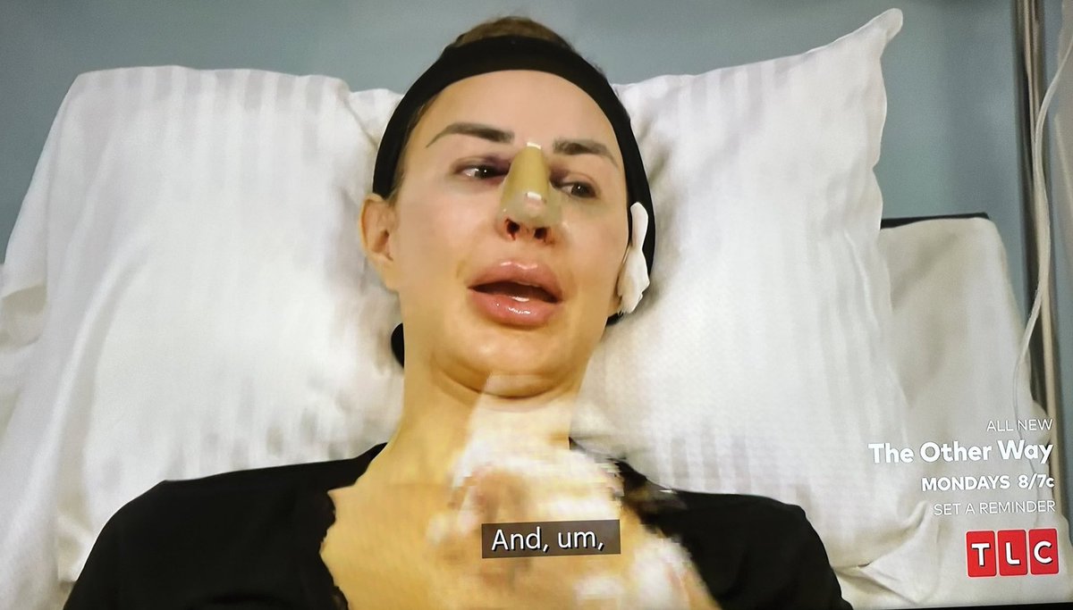 Imagine choosing to purposefully do this to yourself 😒🫣😑 #90DayFiance #90DayFianceTheOtherWay