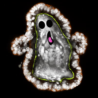 An organoid ghost for #MicroscopyMonday and #MicrosCreepy