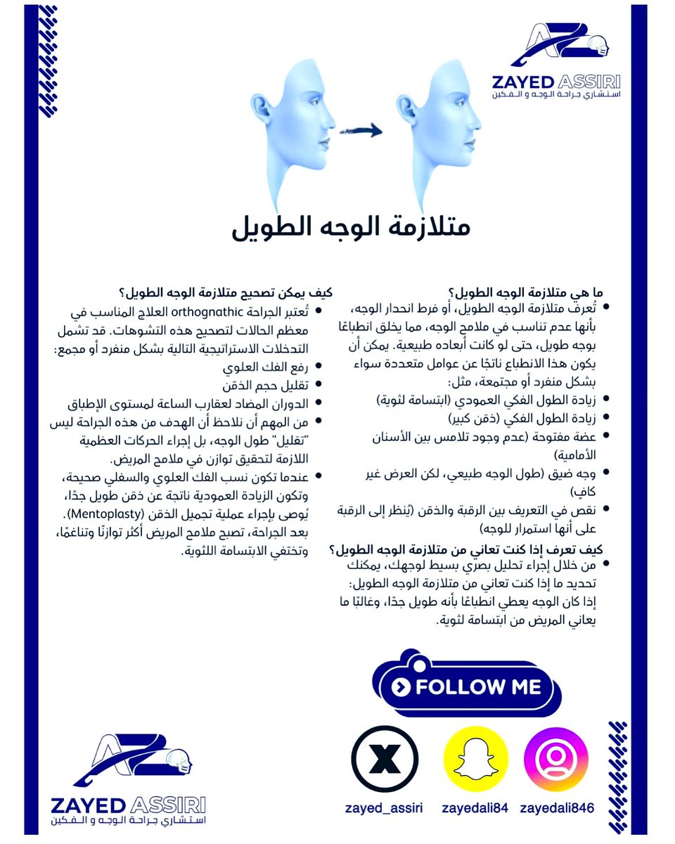 Long face syndrome 
متلازمة الوجه الطويل