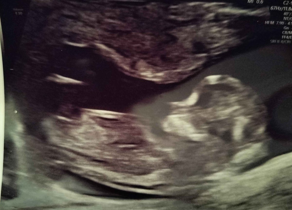 Sector 6 tweet media