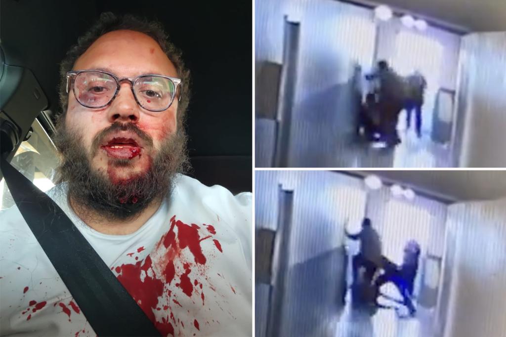 nypost's tweet photo. Pictured: Aurora apartment worker beaten to a pulp by Tren de Aragua — as owners say migrant gang took over and tried to extort them https://t.co/JNcvDmJ4GV https://t.co/K8INeOqim0