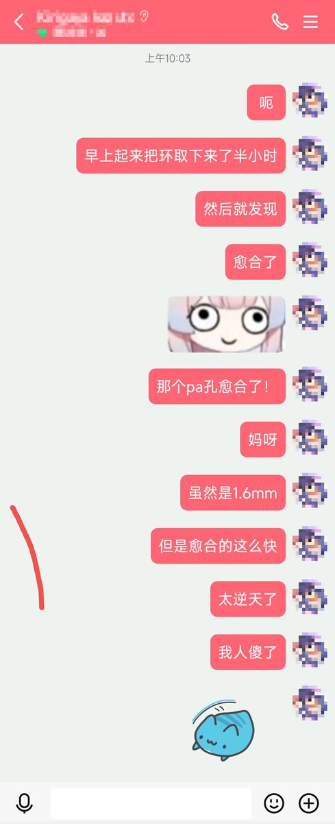 昨天晚上穿的pa孔，第二天早上取环30min愈合。