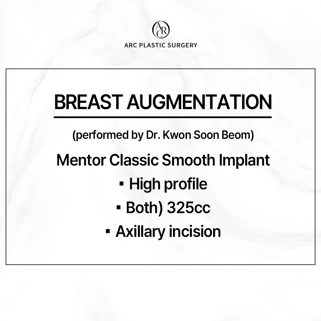 dr_kwonsoonbeom's tweet photo. [FINE ARC]
Breast Augmentation Surgery
***********
Mentor Classic Smooth Implant
: High Profile
- Both) 325cc
- Axillary incision
***********
#arcplasticsurgery #drkwonsoonbeom #breastsurgery #breastaugmentation #Mentorsmooth https://t.co/EXFZ4cjmva