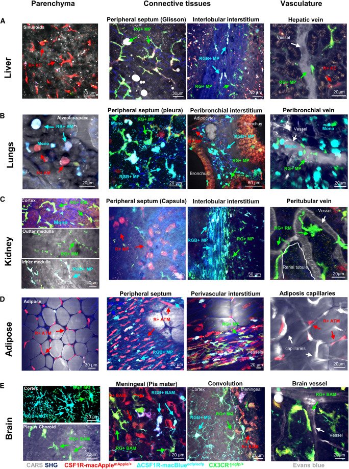 Waggoner Lab (@labwaggoner) on Twitter photo Visualizing the spatial organization of monocytes, interstitial macrophages, and tissue-specific macrophages in situ <a href="/CellReports/">Cell Reports</a>
cell.com/cell-reports/f… Visualizing the spatial organization of monocytes, interstitial macrophages, and tissue-specific macrophages in situ <a href="/CellReports/">Cell Reports</a>
cell.com/cell-reports/f…
